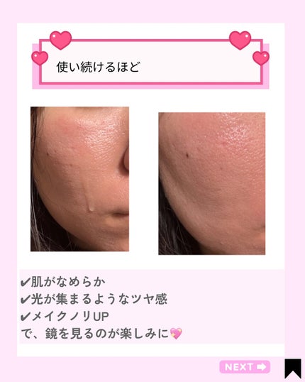 Kana on LIPS 「ナンバーズインのアンバサダーを務めさせていただくことになりまし..」(4枚目)