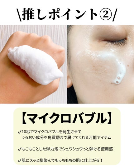 エアバブルCDSマスクU V-アクアボム/GASH/洗い流すパック・マスクを使ったクチコミ(3枚目)