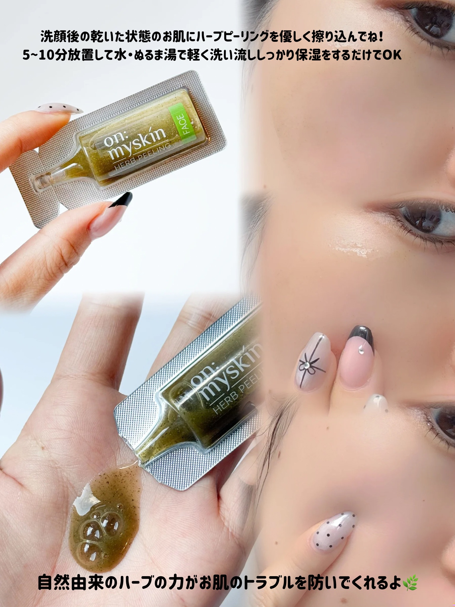 ハーブピーリング/on:myskin/ピーリングを使ったクチコミ（3枚目）