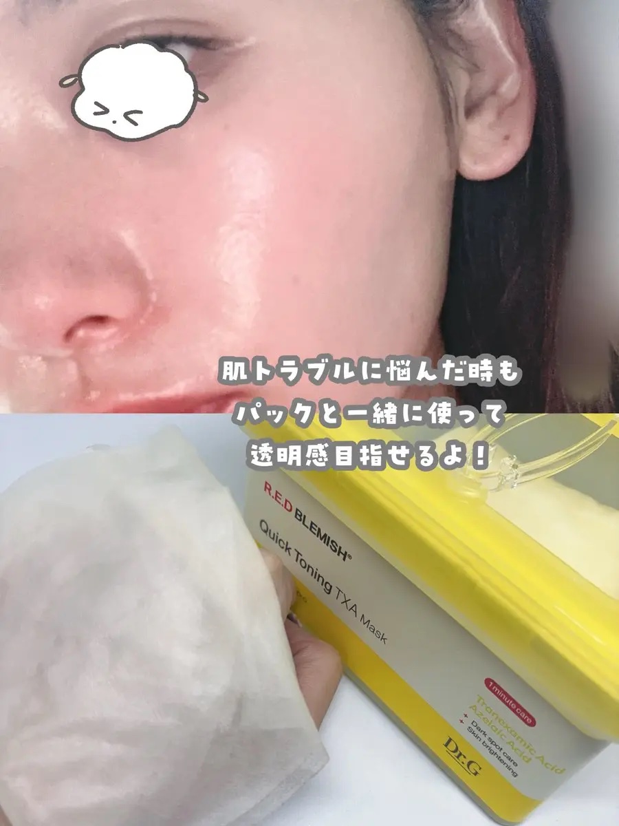 レッドブレミッシュ リペアスージングクリーム/Dr.G/フェイスクリームを使ったクチコミ（3枚目）