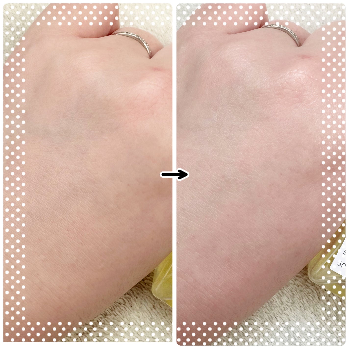 ナイアシンアミドグルタチオンセラム/ONE THING/美容液を使ったクチコミ(4枚目)