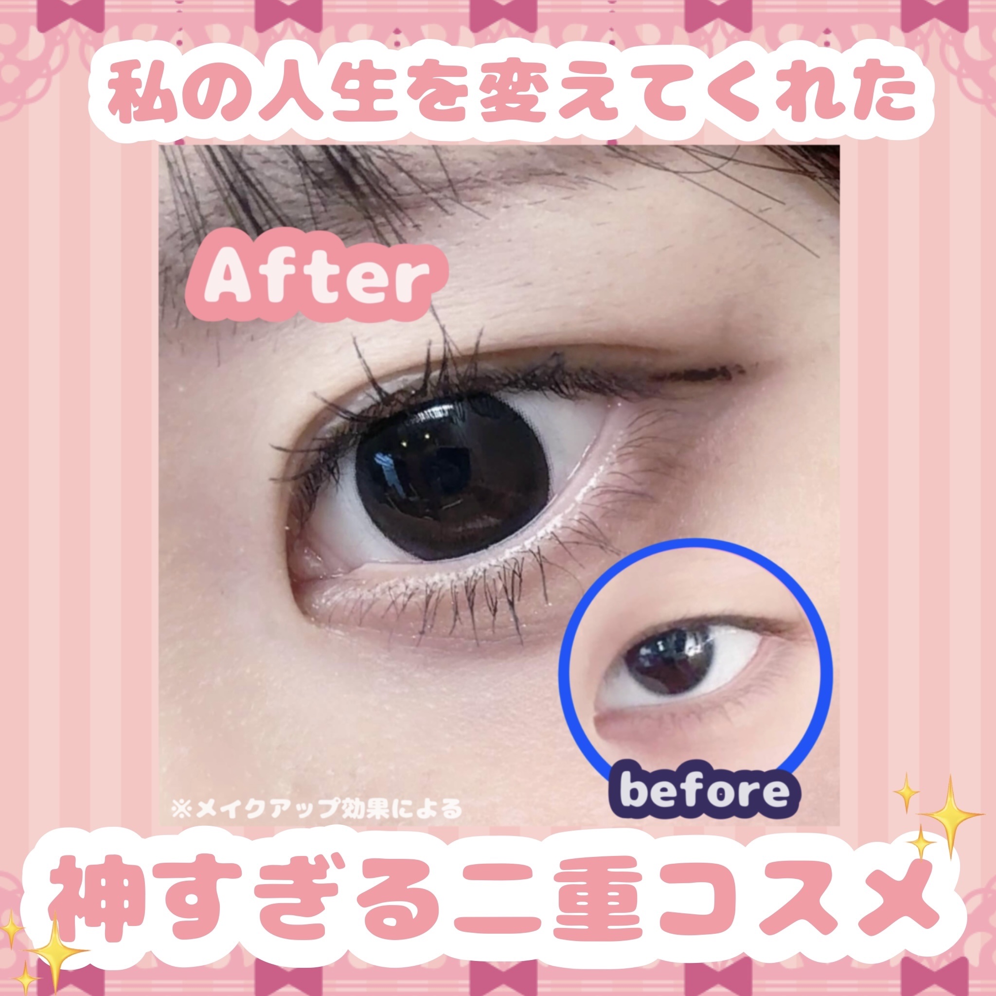 オリシキ アイリッドスキンフィルム EX/D-UP/二重まぶた用アイテムを使ったクチコミ（1枚目）