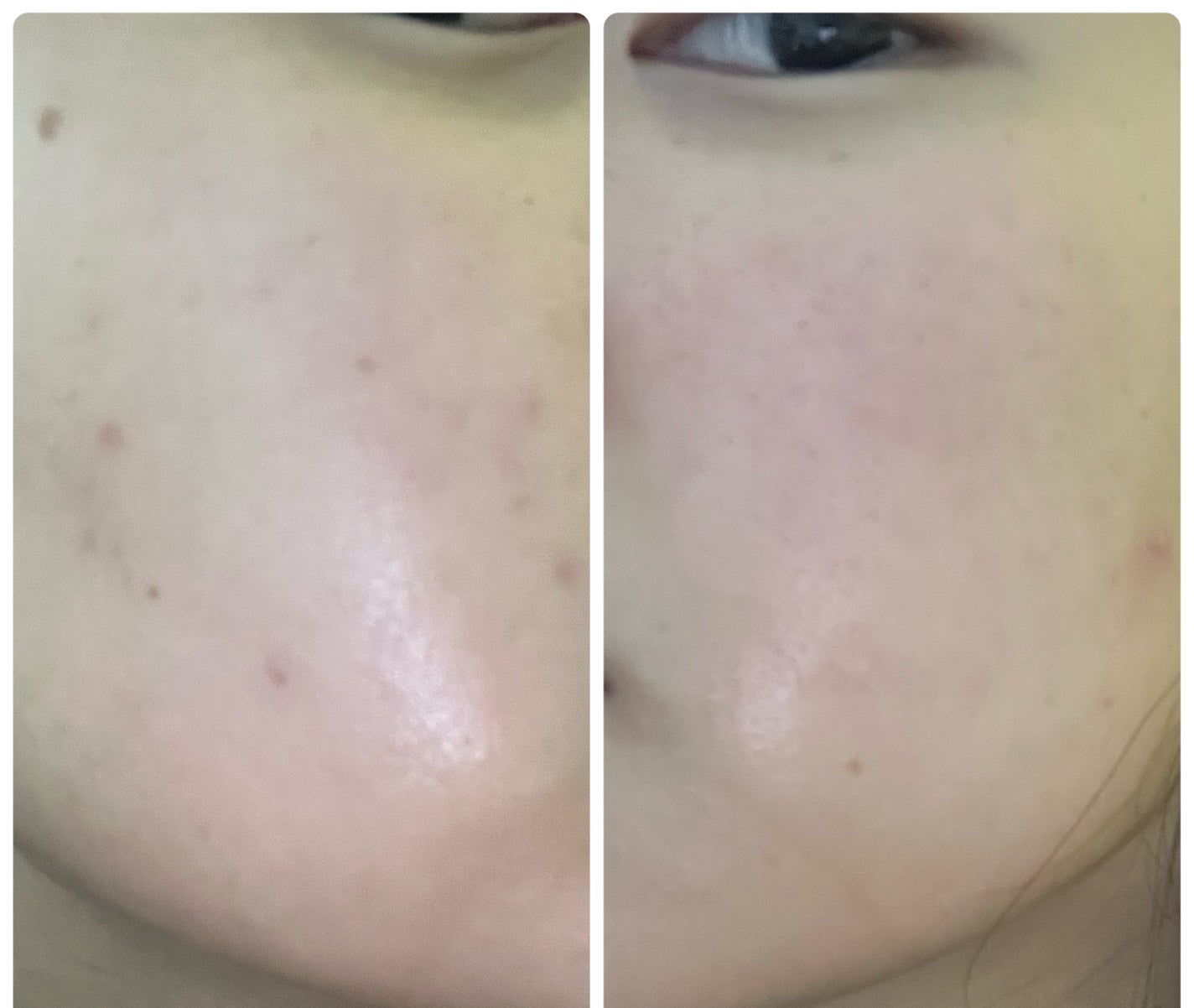 ぽむ on LIPS 「1枚目 2025.11.17エピデュオ 796日目2枚目 20..」(2枚目)