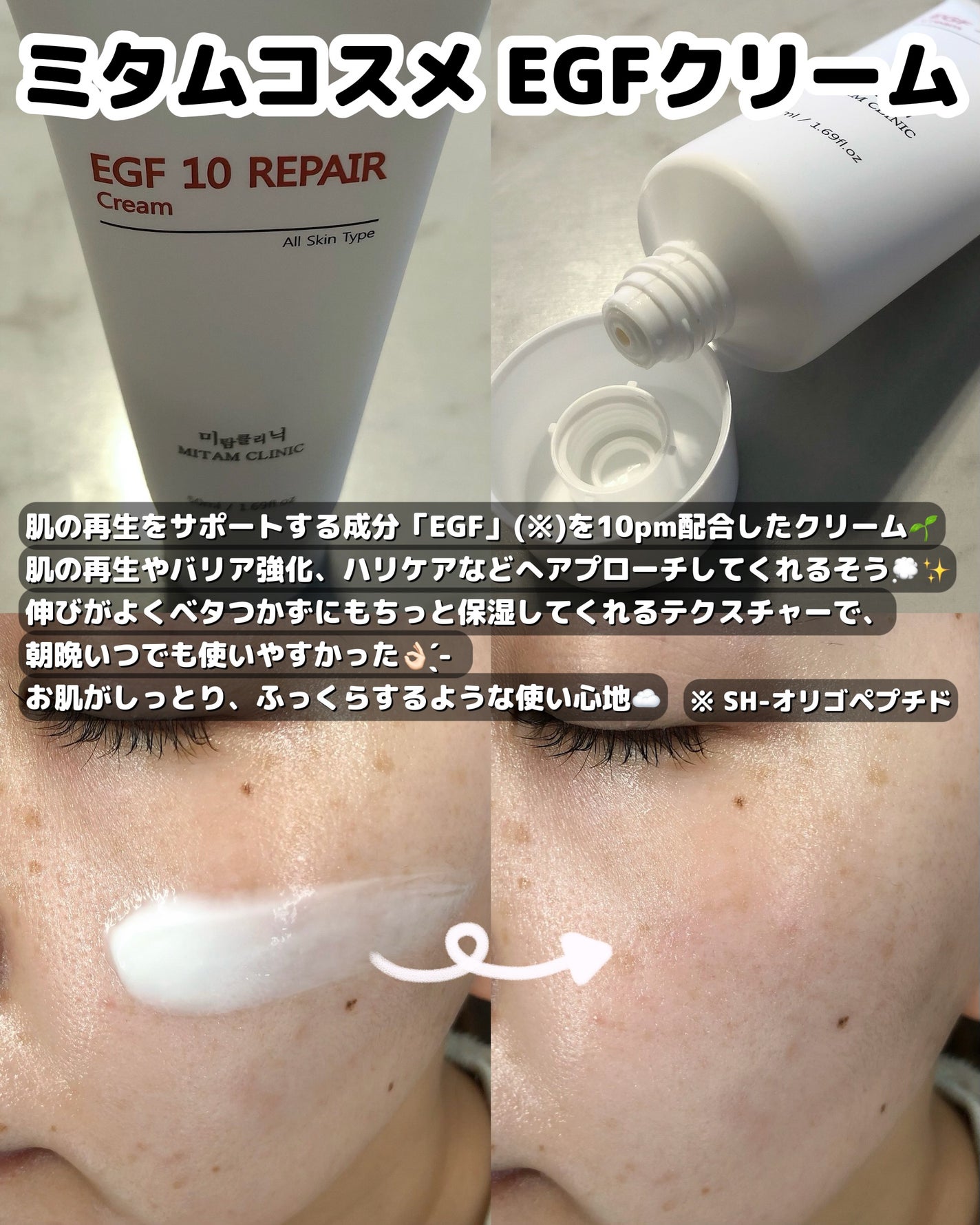 EGFクリーム/Mitam Clinic/フェイスクリームを使ったクチコミ(3枚目)