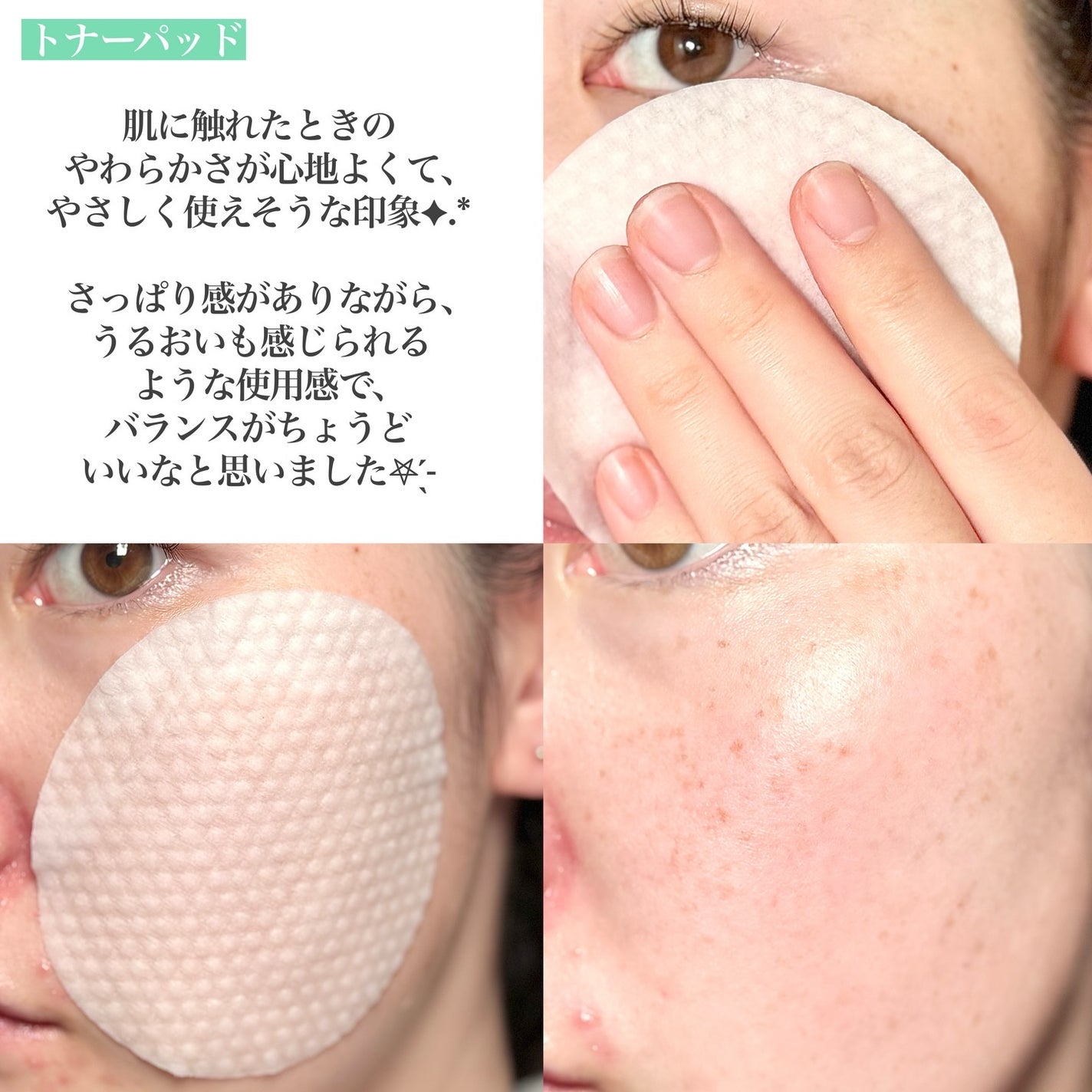 ビーガントナーパッド/CHOROK CHORONG/トナーパッドを使ったクチコミ(5枚目)