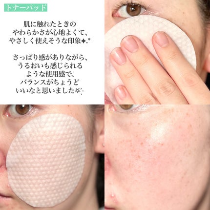 ビーガントナーパッド/CHOROK CHORONG/トナーパッドを使ったクチコミ(5枚目)