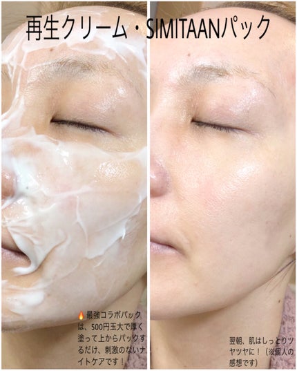 EGFクリーム/Mitam Clinic/フェイスクリームを使ったクチコミ(3枚目)