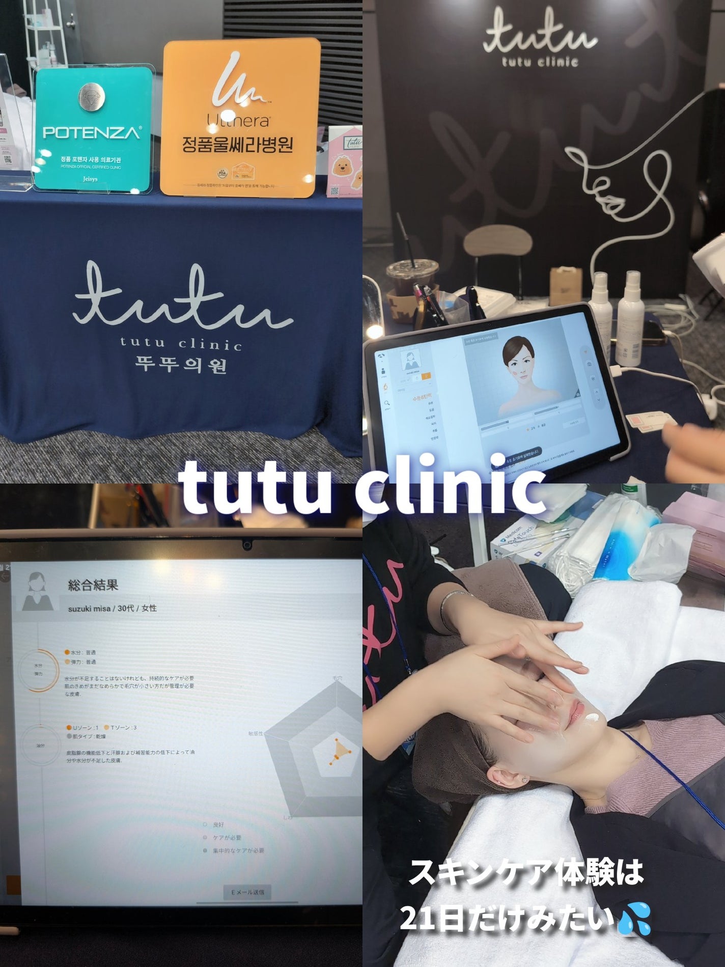 ã¿ãŒããðŸãã©ãã100 on LIPS ãåå ããŠããããð¥°ððïŒã³ã¹ã¡ãã¹ãã³ã±ã¢ãã€ã³ããŒãã¥ãŒã..ãïŒ8æç®ïŒ