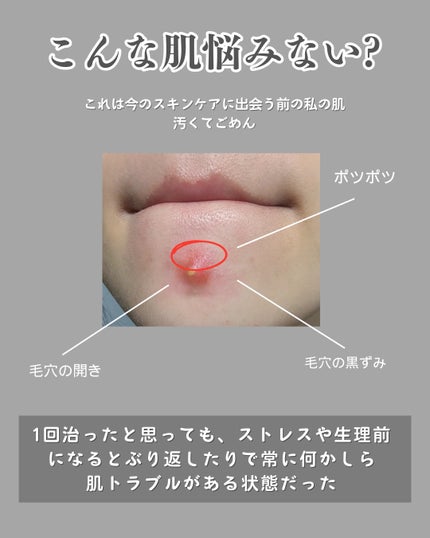 を使ったクチコミ(2枚目)