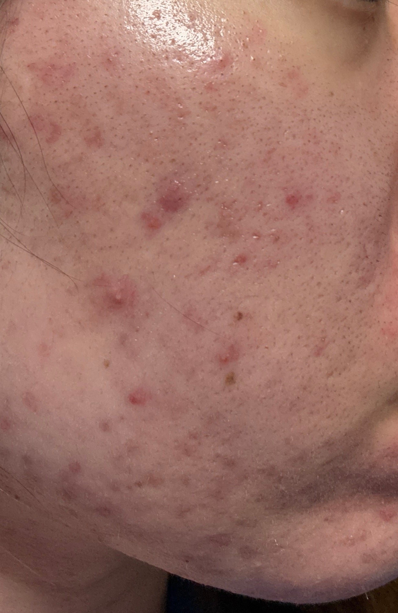 薬用泡洗顔/なめらか本舗/泡洗顔を使ったクチコミ(3枚目)