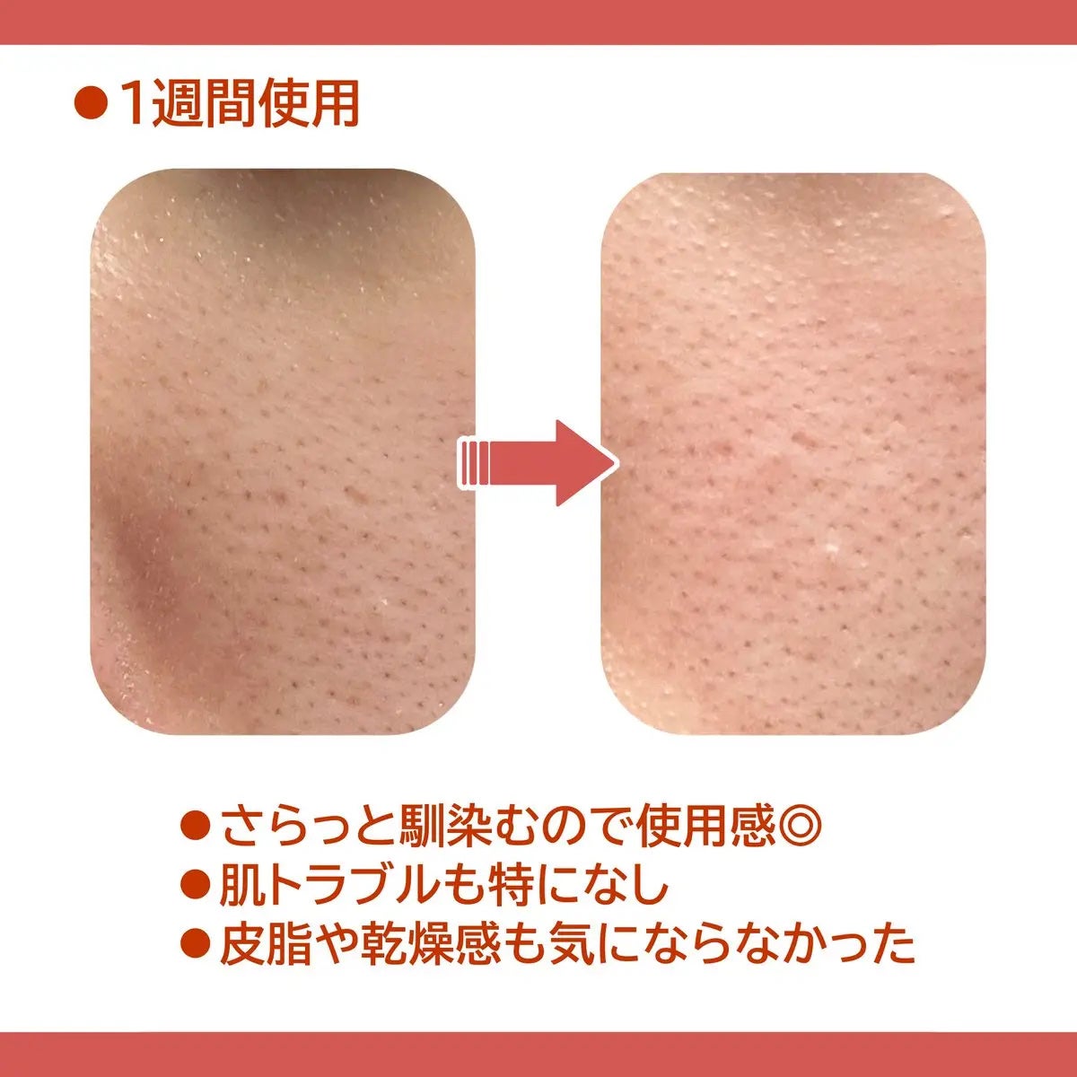 AZケア トナー/VT/化粧水を使ったクチコミ(3枚目)