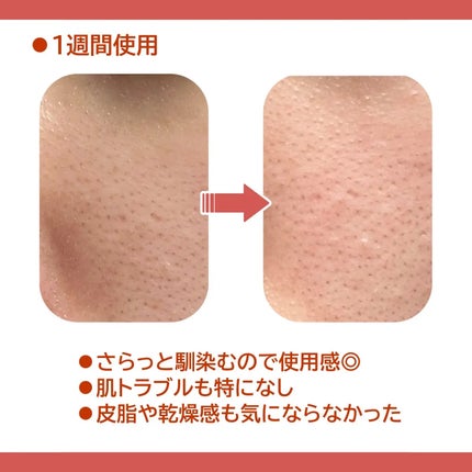 AZケア トナー/VT/化粧水を使ったクチコミ(3枚目)