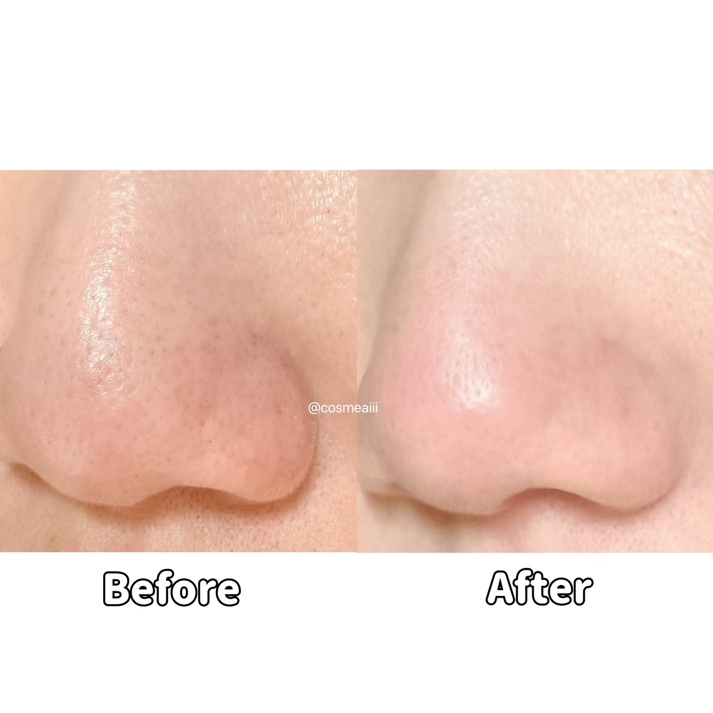 ブラックヘッドバームスクラブ/オブジェ/フェイスバームを使ったクチコミ(7枚目)