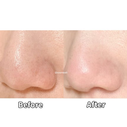 ブラックヘッドバームスクラブ/オブジェ/フェイスバームを使ったクチコミ(7枚目)