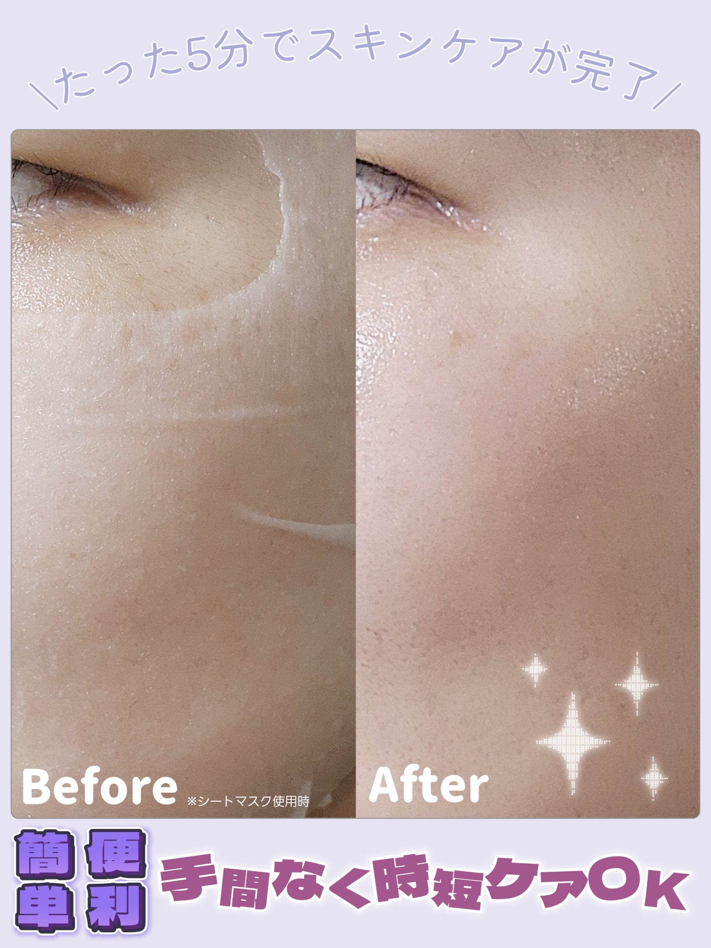 PDRN リフティングマスク/MEDIHEAL/シートマスク・パックを使ったクチコミ(3枚目)