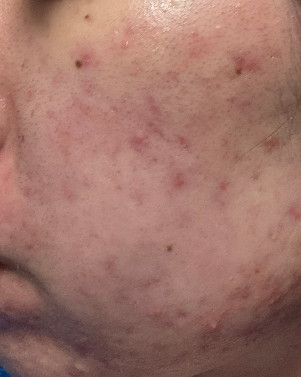 薬用泡洗顔/なめらか本舗/泡洗顔を使ったクチコミ(2枚目)