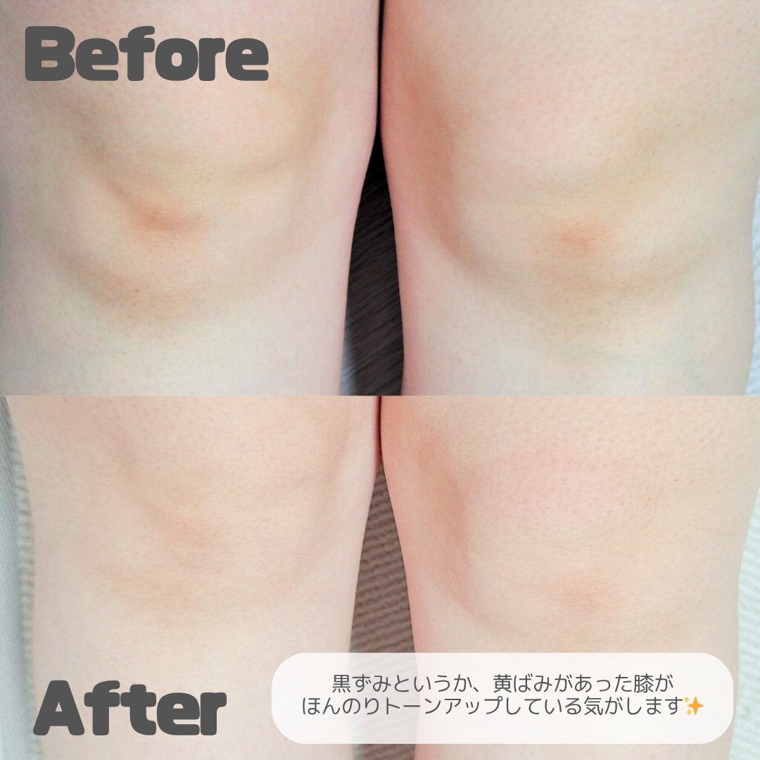 BnDアンダーアームクリーム(ボディクリーム)/BnD/デリケートゾーンケアを使ったクチコミ(3枚目)