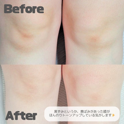 BnDアンダーアームクリーム(ボディクリーム)/BnD/デリケートゾーンケアを使ったクチコミ(3枚目)