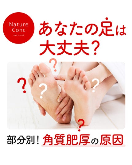 ネイチャーコンク薬用フットケアローション/ネイチャーコンク/レッグ・フットケアを使ったクチコミ(1枚目)