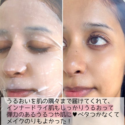 リアルヒアルロニックブルーアンプル 100/Wellage/美容液を使ったクチコミ(8枚目)