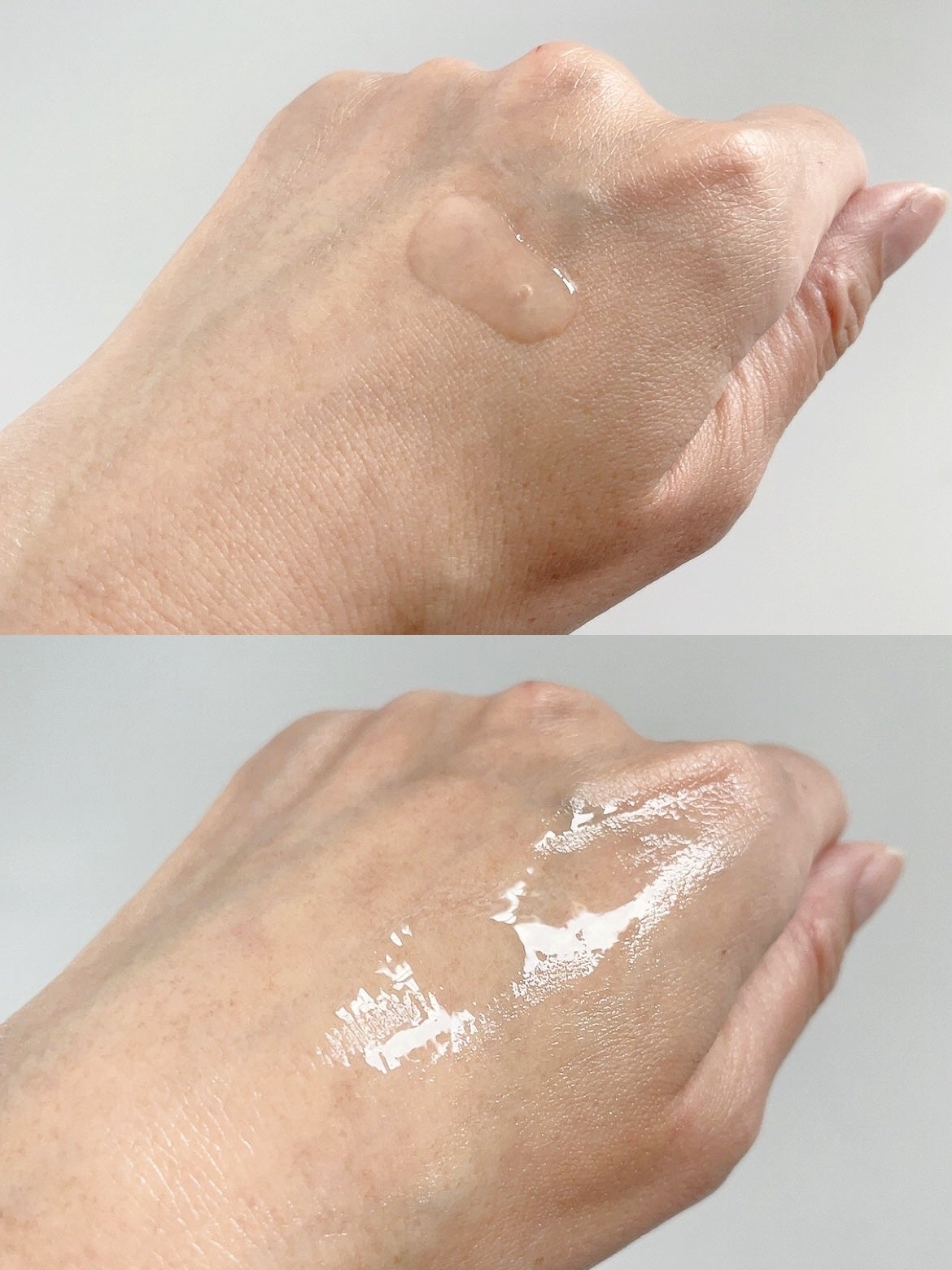 バイオームレメディポアリセットPDRN セラム/UIQ/美容液を使ったクチコミ(7枚目)