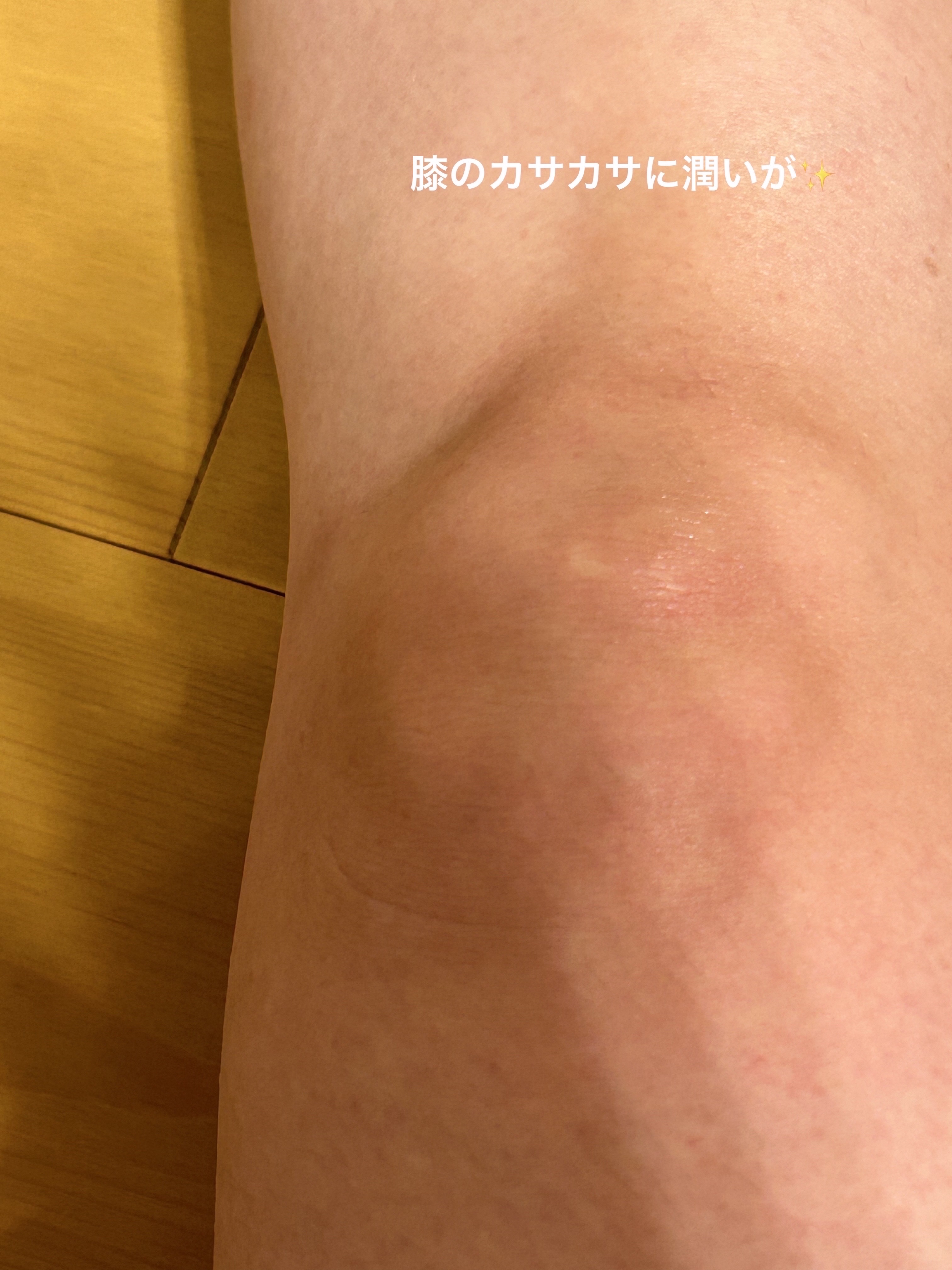 BnDアンダーアームクリーム(ボディクリーム)/BnD/デリケートゾーンケアを使ったクチコミ（3枚目）