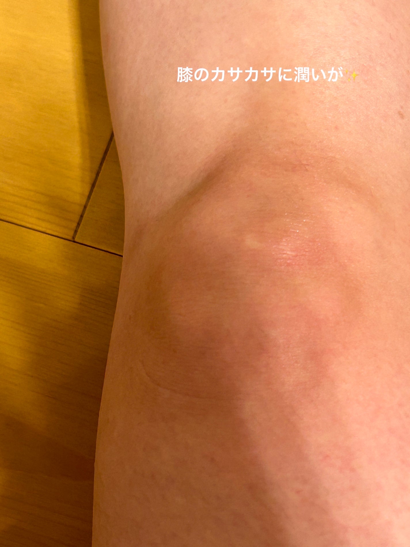 BnDアンダーアームクリーム(ボディクリーム)/BnD/デリケートゾーンケアを使ったクチコミ(3枚目)