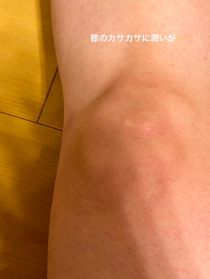 BnDアンダーアームクリーム(ボディクリーム)/BnD/デリケートゾーンケアを使ったクチコミ(3枚目)