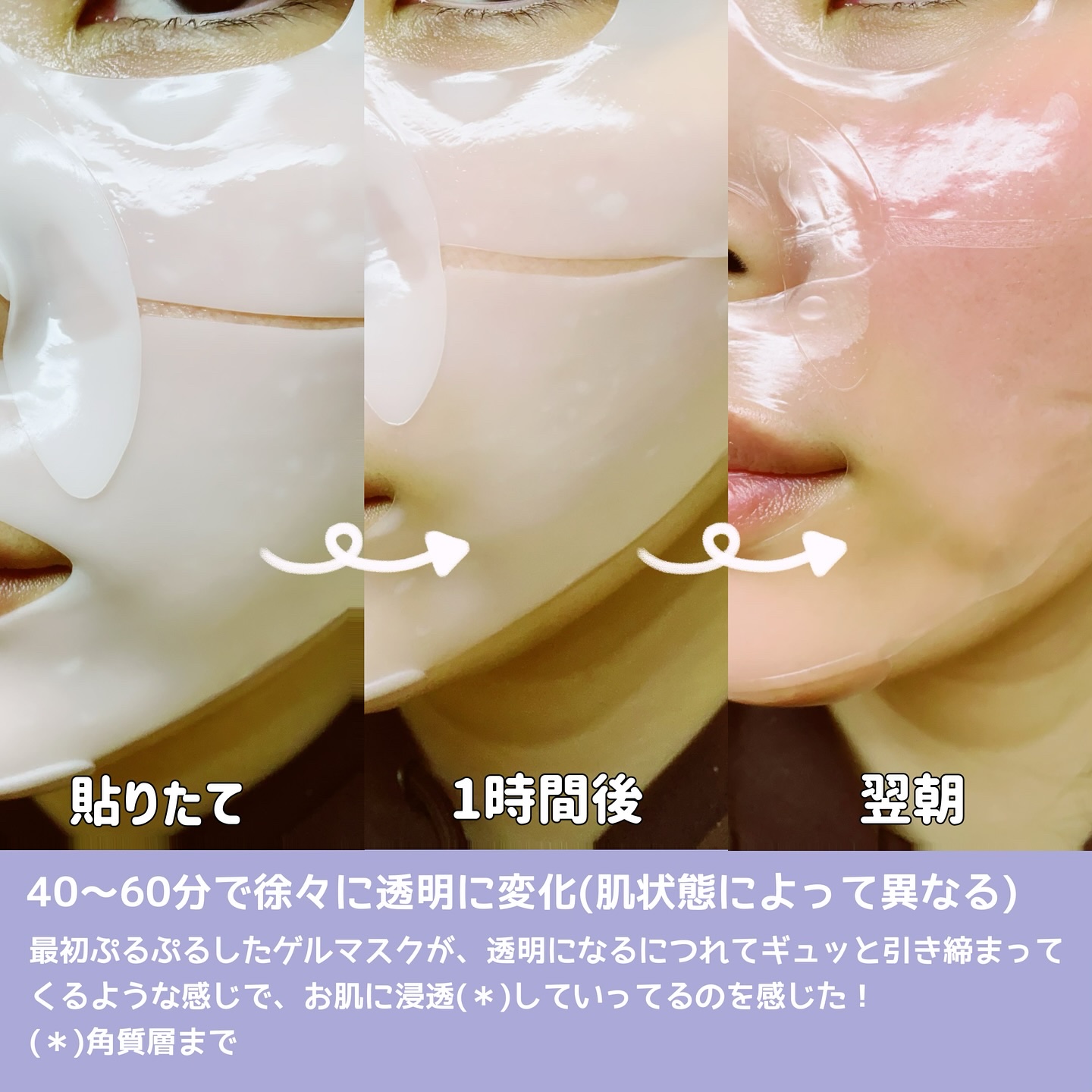 コラーゲンバウンスアップハイパーアクティブゲルマスク/SNP/シートマスク・パックを使ったクチコミ（3枚目）