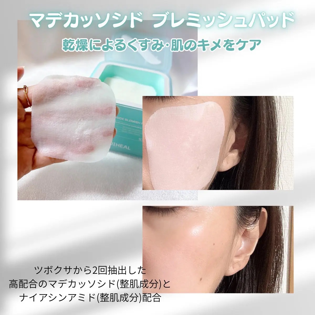 マデカソサイド ブレミッシュパッド/MEDIHEAL/トナーパッドを使ったクチコミ（3枚目）