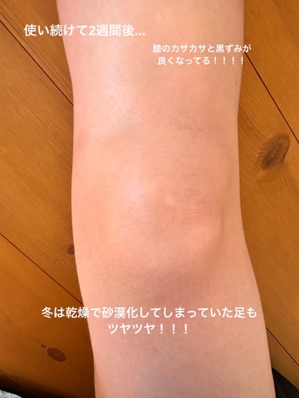 BnDアンダーアームクリーム(ボディクリーム)/BnD/デリケートゾーンケアを使ったクチコミ(4枚目)