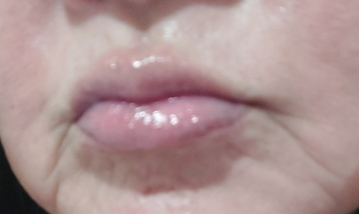 ナイトニードルリップ ディープモイスト/CHOOSY/リップ美容液を使ったクチコミ(4枚目)