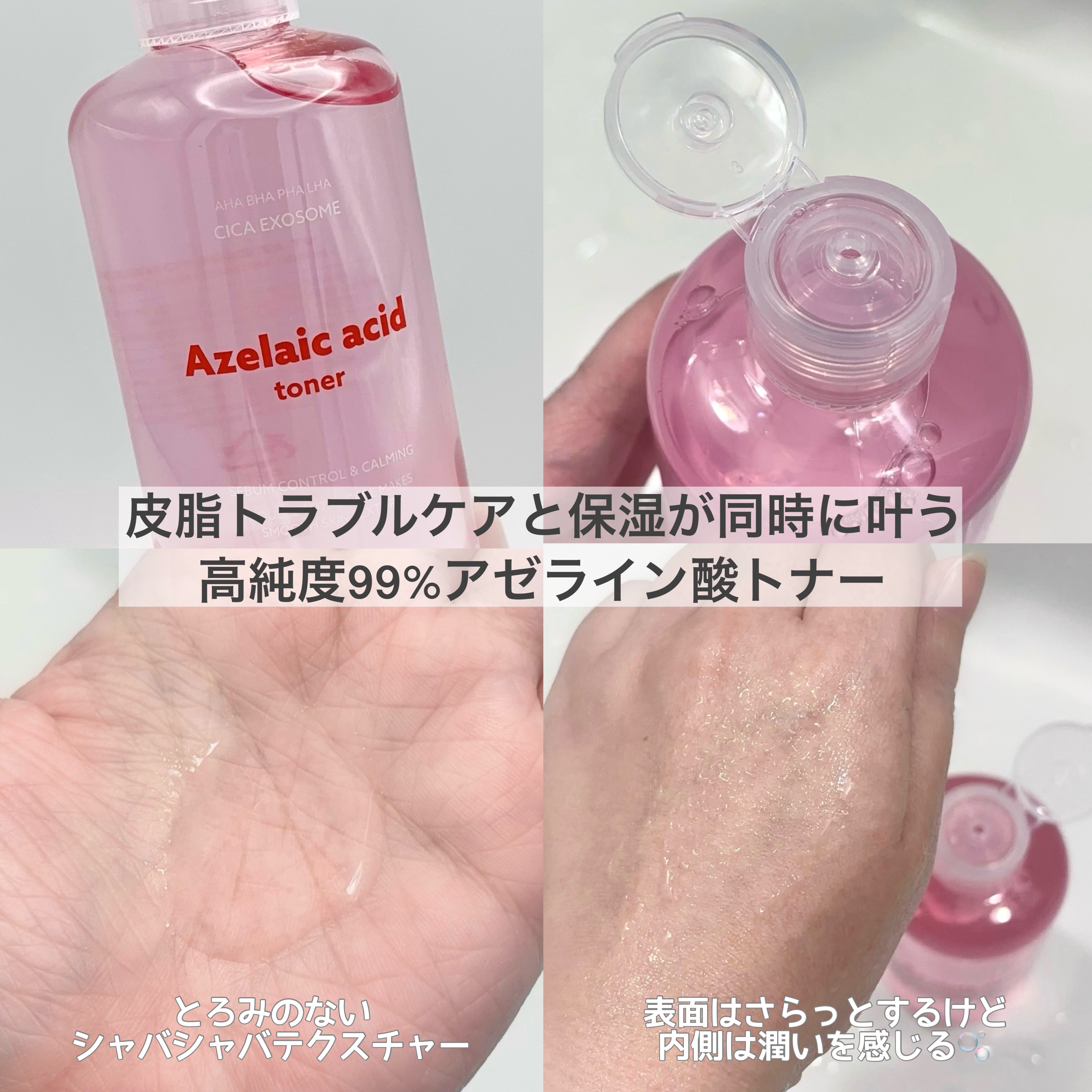 AZケア トナー/VT/化粧水を使ったクチコミ（2枚目）