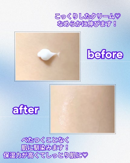 Abo on LIPS 「やっほーAboです🤍✨@dr.oracle_official...」(4枚目)