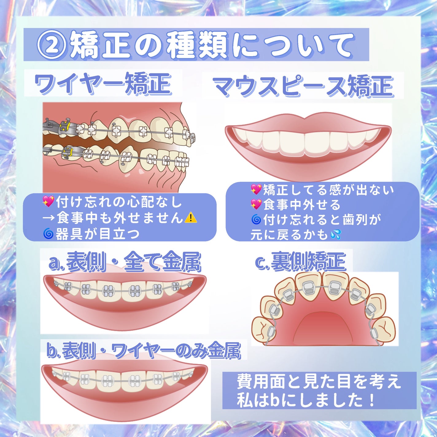 macaron@フォロバ100 on LIPS 「【完全保存版!私の歯列矯正記録🦷】今回は2年半行った私の歯列矯..」(3枚目)