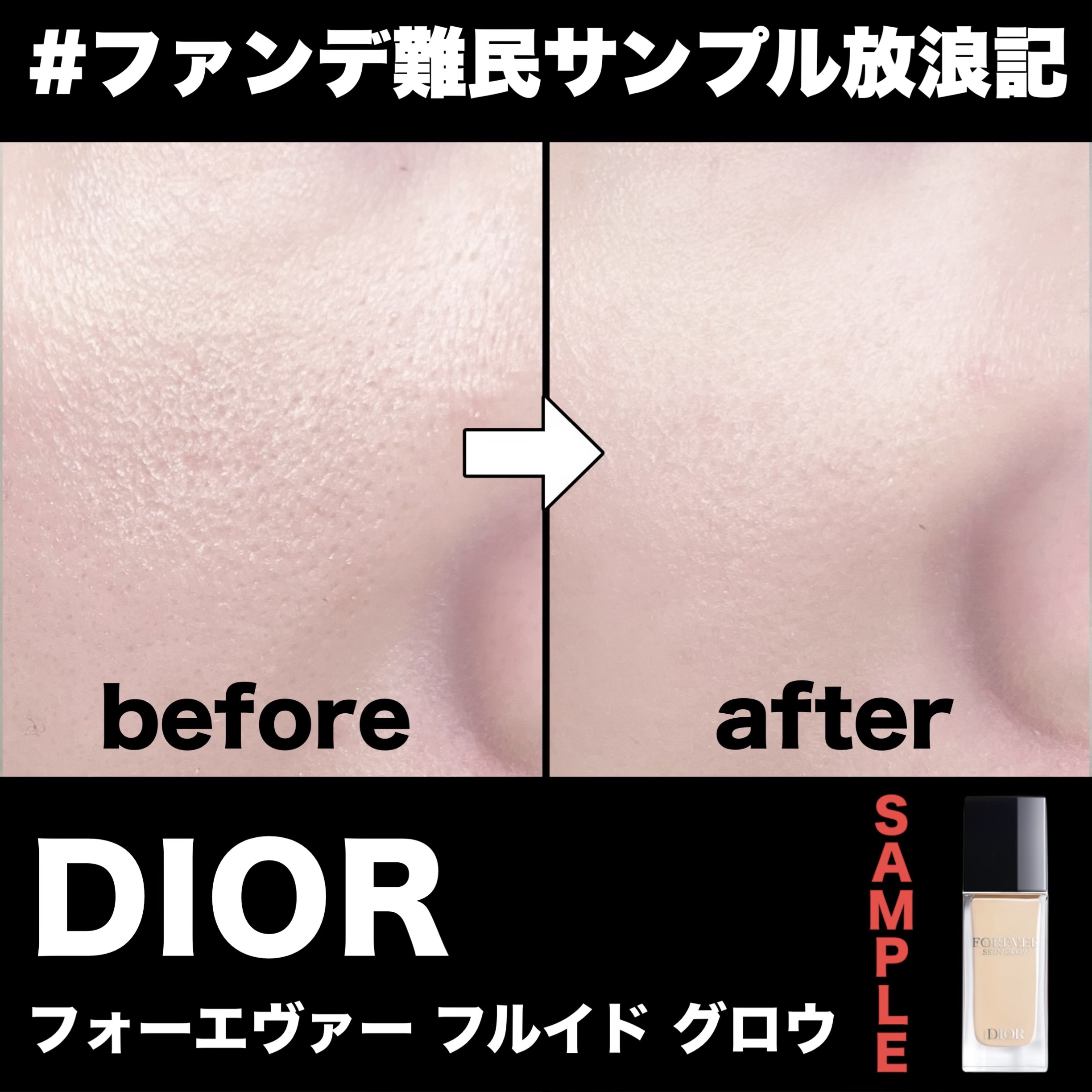 ディオールスキン フォーエヴァー フルイド グロウ 0CRクール ロージー/Dior/リキッドファンデーションを使ったクチコミ（1枚目）