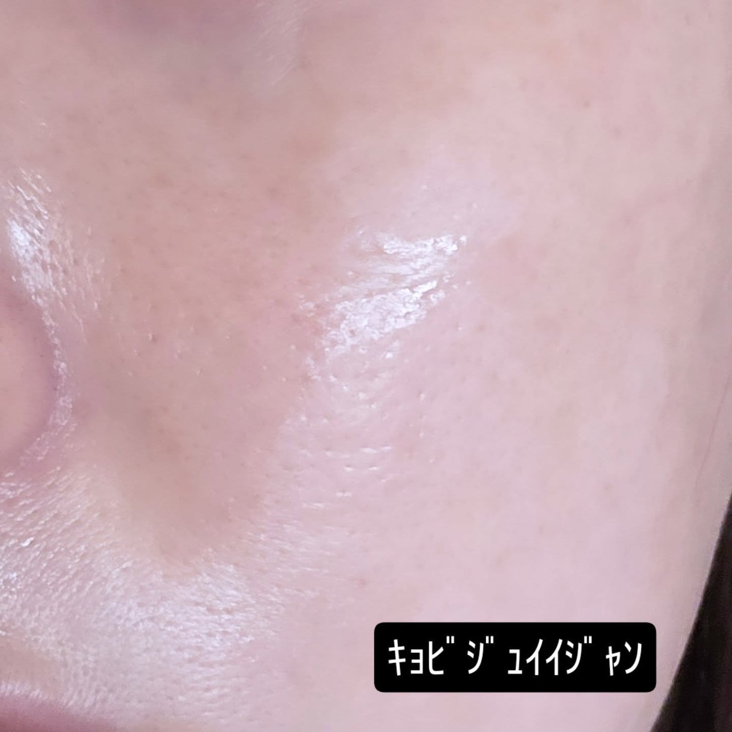 アズレンシカカーミングマスク/from medi+/シートマスク・パックを使ったクチコミ(10枚目)