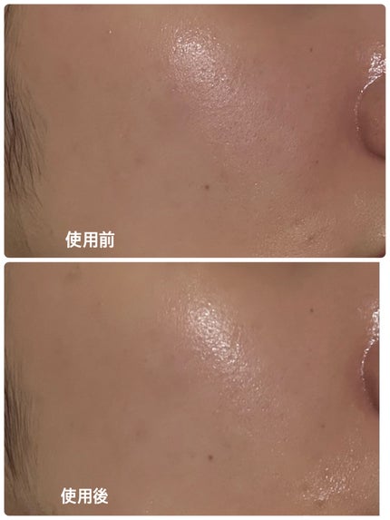 PDRNグロウセラム4.0ポンプ/Abib /美容液を使ったクチコミ(6枚目)