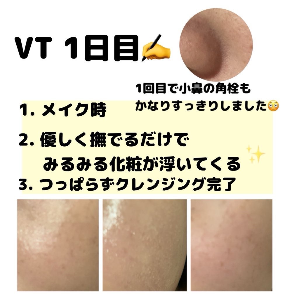 AZケア クレンジングオイル/VT/オイルクレンジングを使ったクチコミ(2枚目)