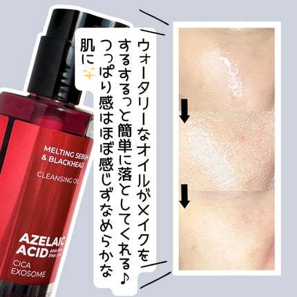 AZケア クレンジングオイル/VT/オイルクレンジングを使ったクチコミ(2枚目)