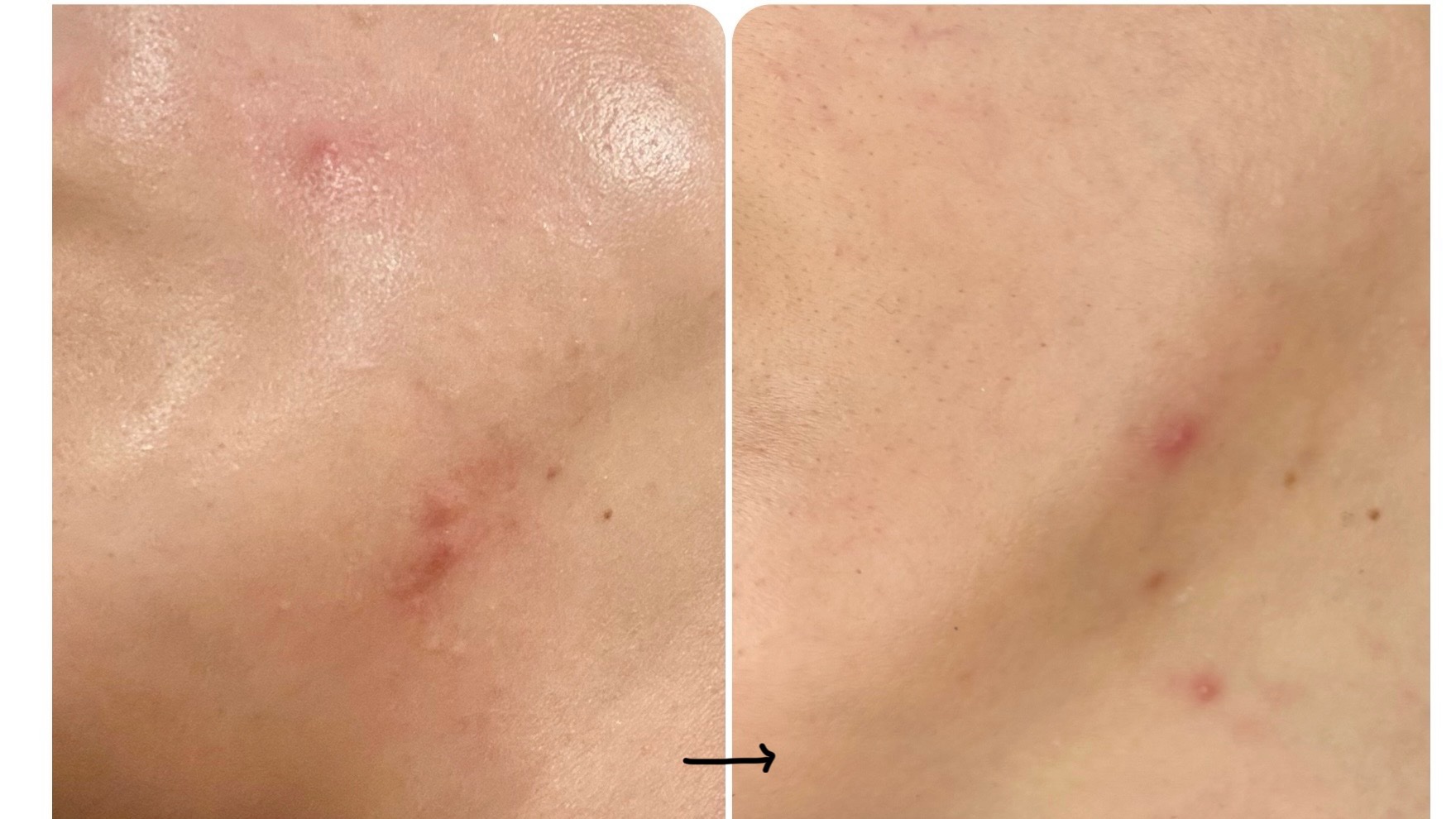 女性保健薬 命の母A (医薬品)/命の母/その他を使ったクチコミ（3枚目）