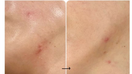 女性保健薬 命の母A (医薬品)/命の母/その他を使ったクチコミ(3枚目)