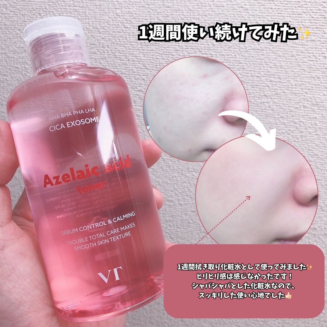 AZケア トナー/VT/化粧水を使ったクチコミ（3枚目）