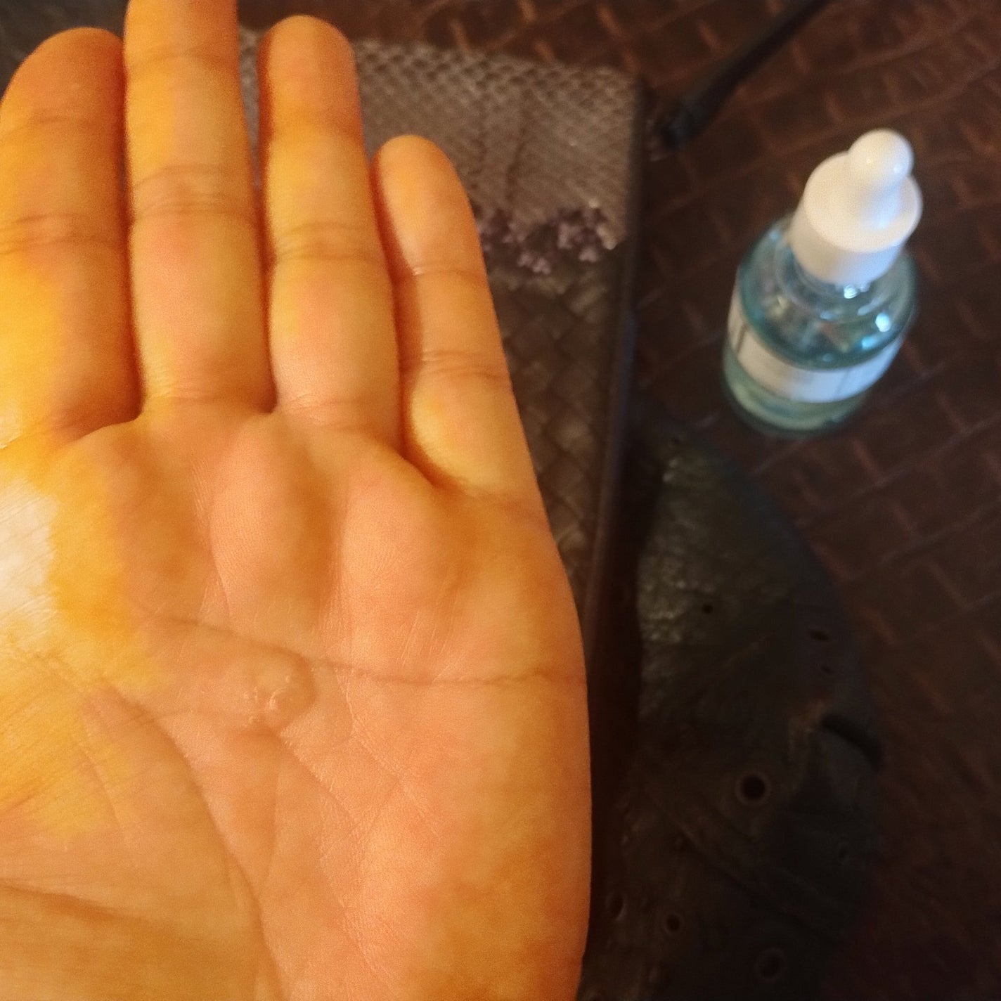 mcgroupakiko on LIPS 「激しい乾燥で今年初めて、エキゾチックレザーバリに肘が割れてしま..」(7枚目)