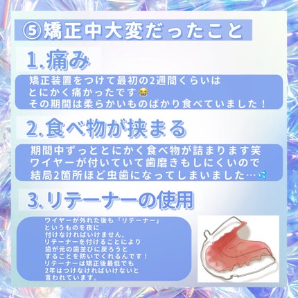 macaron@フォロバ100 on LIPS 「【完全保存版!私の歯列矯正記録🦷】今回は2年半行った私の歯列矯..」(6枚目)