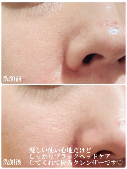 青麦クレンジングジェル /Veganifect/クレンジングジェルを使ったクチコミ(3枚目)