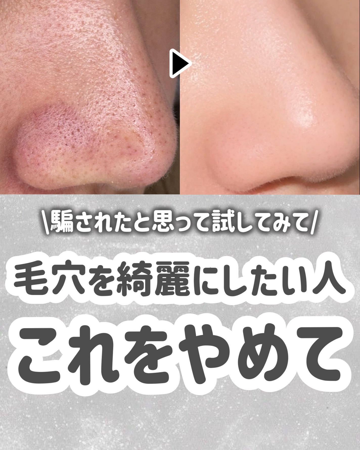 ミセラークレンジングシート セラムモイスト/ビフェスタ/クレンジングシートを使ったクチコミ(9枚目)