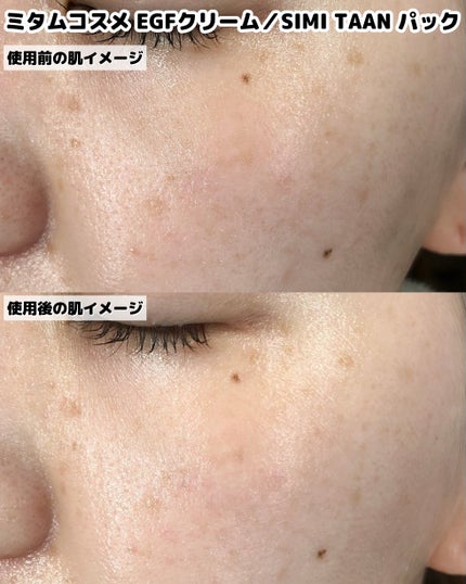 EGFクリーム/Mitam Clinic/フェイスクリームを使ったクチコミ(4枚目)