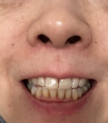 ピュオーラ 炭酸ハミガキ【医薬部外品】/ピュオーラ/歯磨き粉を使ったクチコミ(7枚目)