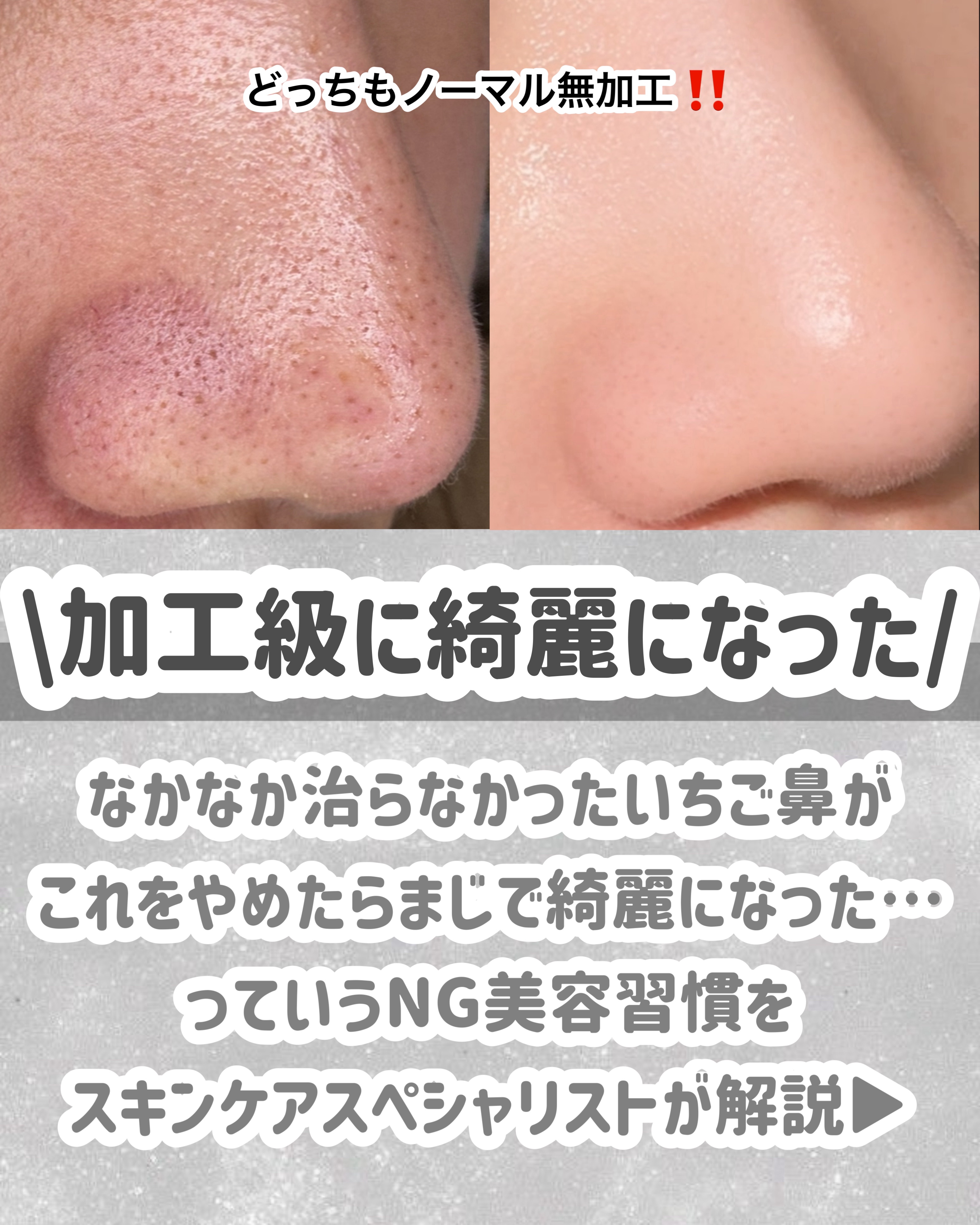 導入化粧液/無印良品/ブースター・導入液を使ったクチコミ（2枚目）